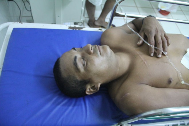 Francisco das Chagas (28) também foi ferido nas costelas do lado direito pelo mesmo agressor