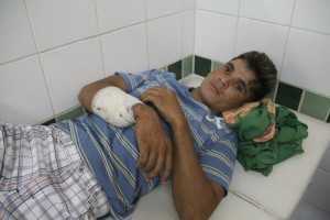  José Aparecido Figueiredo da Silva (21), também foi ferido por 'Tôco' após acertar seu irmão - Foto: Alexandre Lima
